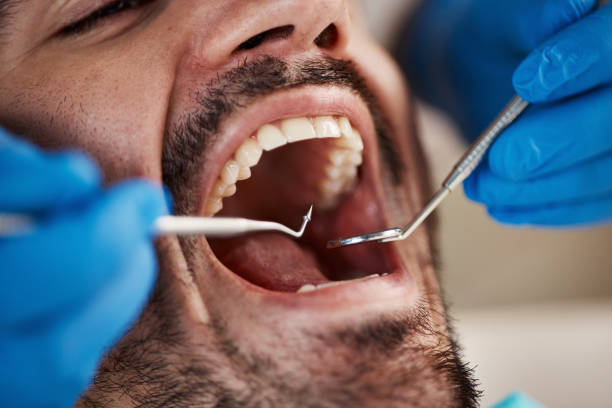 Best Walk-In Emergency Dentist in Oakwood, PA